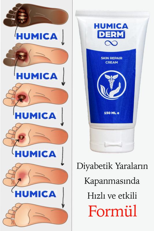 Humicaderm Cilt Onarıcı, Yara Bakım Kremi 150ml